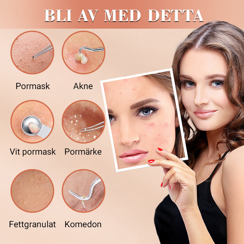 ⚕️ Professionell hudvård! ✨ Medicinskt stålkit för borttagning av pormaskar, 7 delar