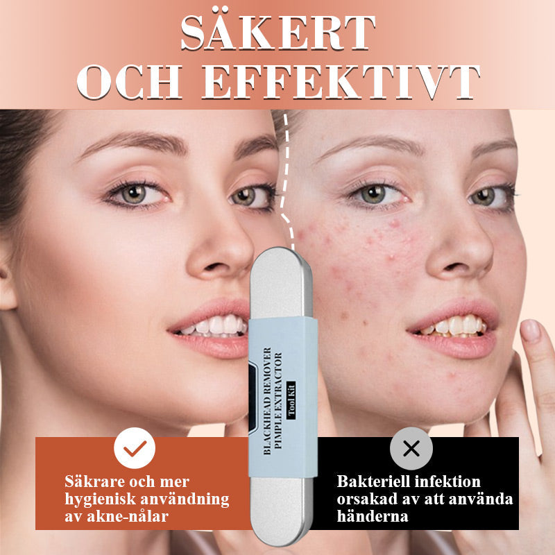 ⚕️ Professionell hudvård! ✨ Medicinskt stålkit för borttagning av pormaskar, 7 delar
