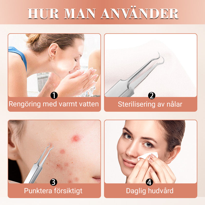⚕️ Professionell hudvård! ✨ Medicinskt stålkit för borttagning av pormaskar, 7 delar